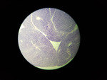 MISSING THUMBNAIL